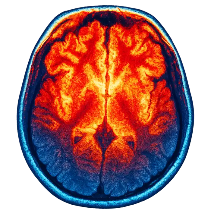 Brain scan colorized for effect