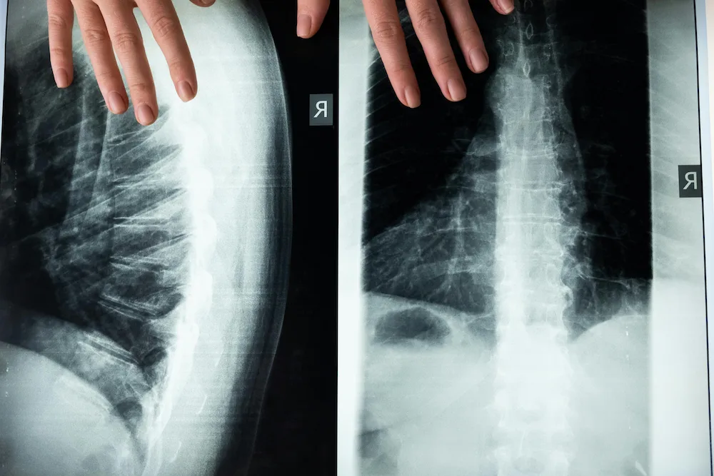 chiropractic professional assessing spine during consultation